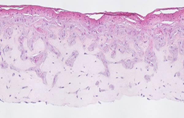 In vitro Skin Absorption Tests