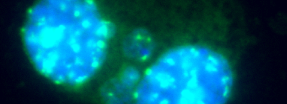 in vitro Micronucleus Test, MNvit, chromosomal aberration