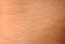 XenoSkin P - Ex vivo Full Thickness Pig Skin Model for in...